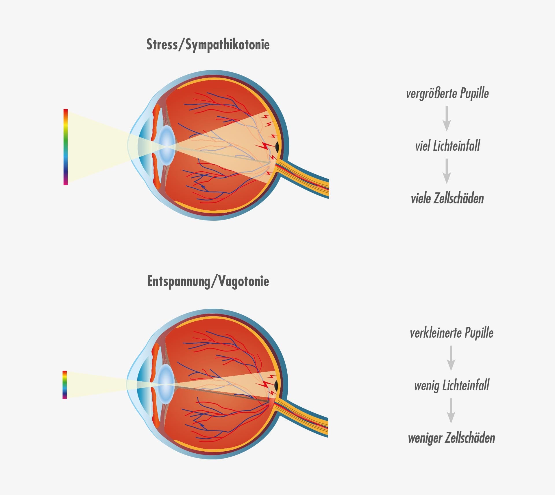Altersbedingte Makuladegeneration AMD, Lichteinfall ins Auge Altersbedingte Makuladegeneration AMD, Lichteinfall ins Auge, schematische Darstellung