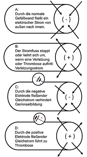 Darstellung des Stromflusses im Blutgefäß Bild: Darstellung des Stromflusses im Blutgefäß