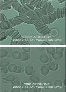 Abbildung 4: Verändernde Wirkung von Airnergy auf die Blutzellen