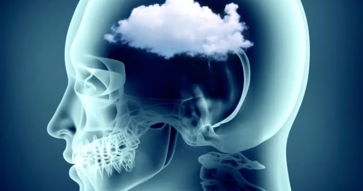 Airnergy bei Brain Fog - Der Nebel im Gehirn_q